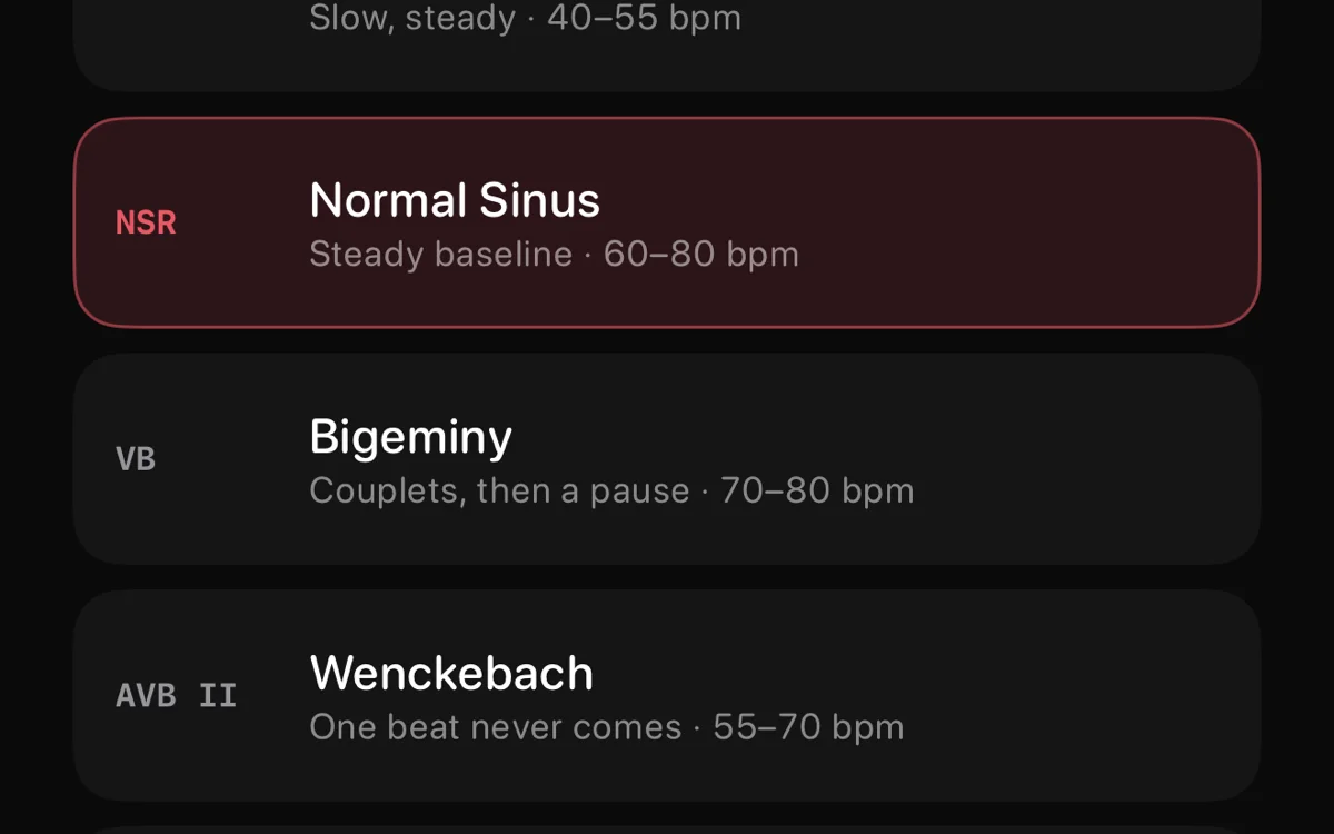 Rhythm picker listing Normal Sinus, Bigeminy, and Wenckebach on a dark card list.